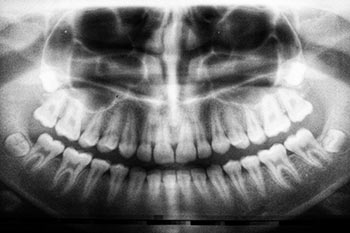 Dental Clinic sample website by jefawk.com with oral pathology