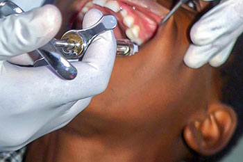 Dental Clinic sample website by jefawk.com with endodontics