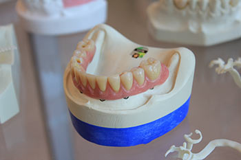 Dental Clinic sample website by jefawk.com with implant dentistry